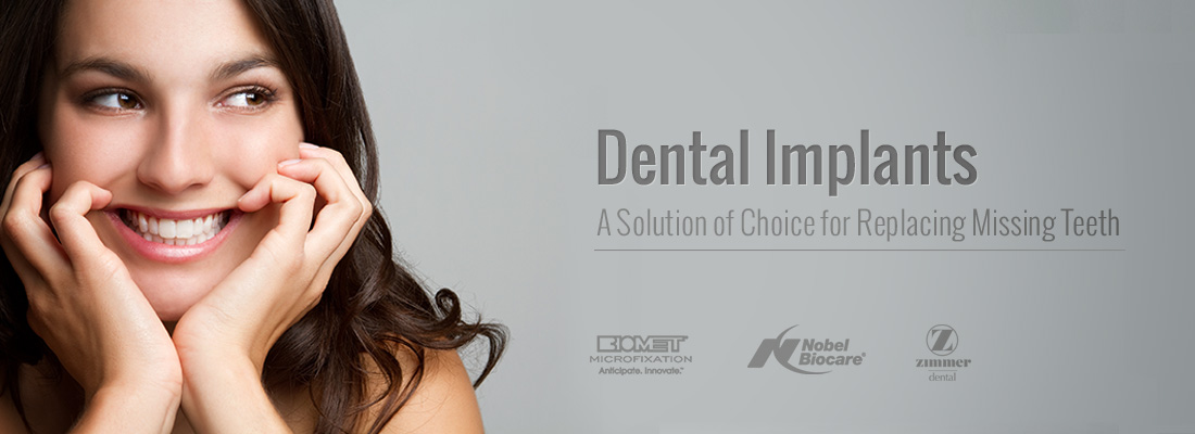 Dental Implants